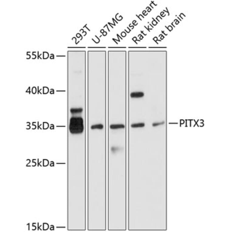Western Blot - Anti-PITX3/PTX3 Antibody (A13000) - Antibodies.com