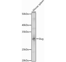 Western Blot - Anti-SLUG Antibody (A13001) - Antibodies.com