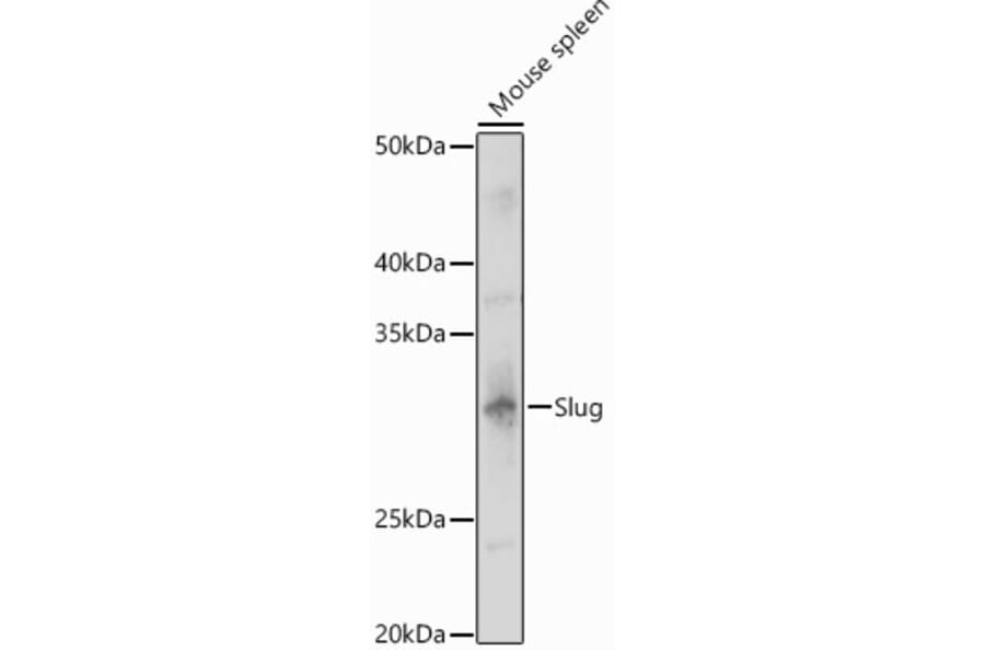 Western Blot - Anti-SLUG Antibody (A13001) - Antibodies.com