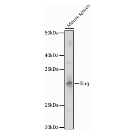 Western Blot - Anti-SLUG Antibody (A13001) - Antibodies.com