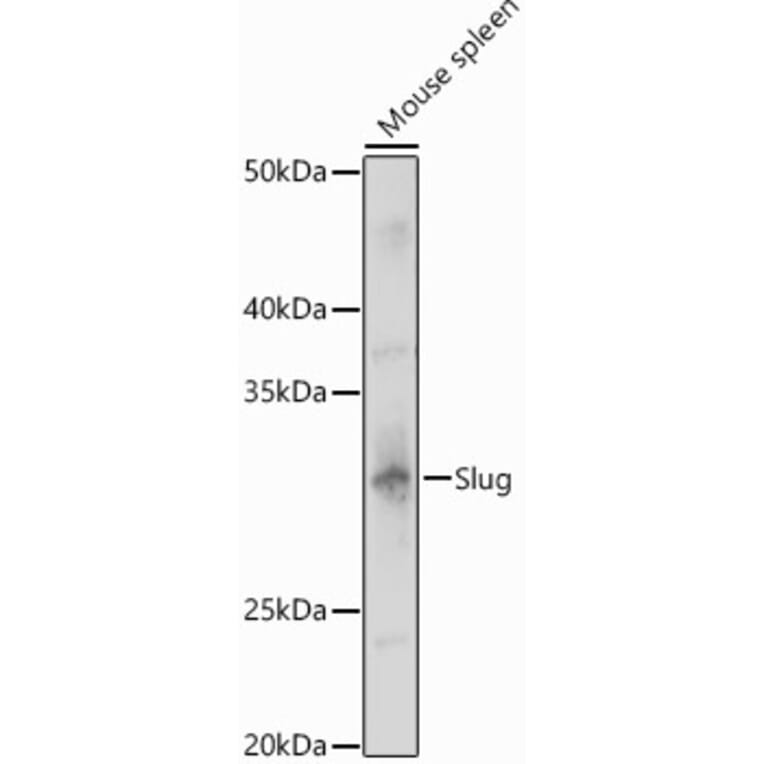 Western Blot - Anti-SLUG Antibody (A13001) - Antibodies.com