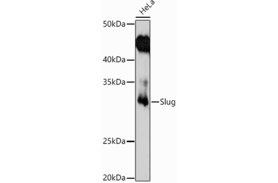 Western Blot - Anti-SLUG Antibody (A13001) - Antibodies.com