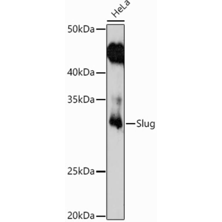 Western Blot - Anti-SLUG Antibody (A13001) - Antibodies.com