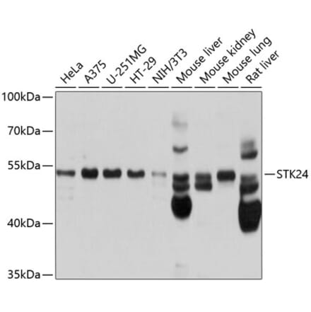 Western Blot - Anti-MST3 Antibody (A13002) - Antibodies.com