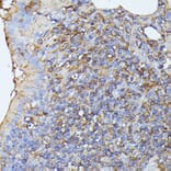 Immunohistochemistry - Anti-MST3 Antibody (A13002) - Antibodies.com