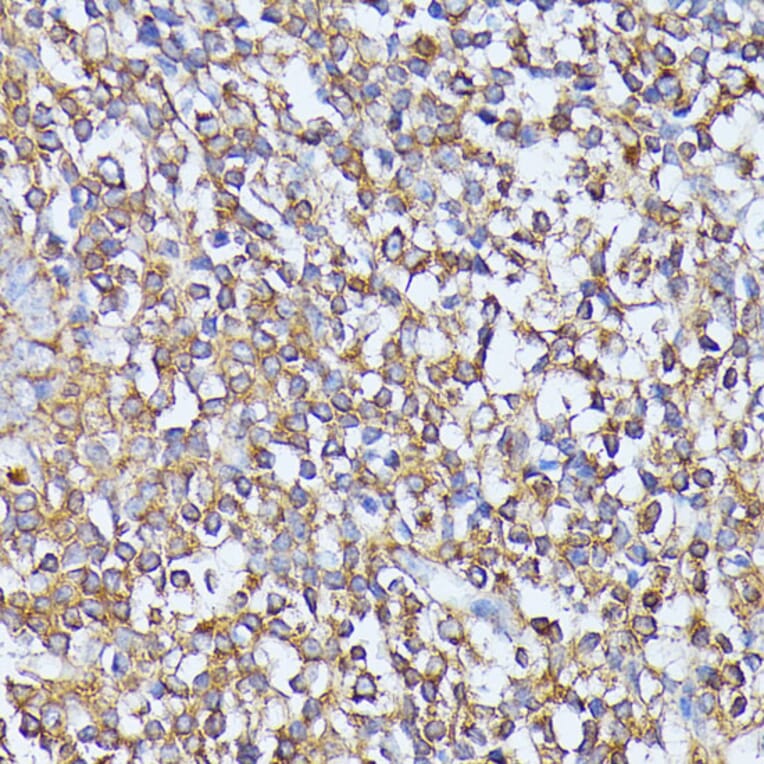 Immunohistochemistry - Anti-MST3 Antibody (A13002) - Antibodies.com
