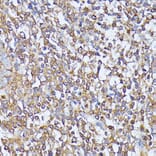 Immunohistochemistry - Anti-MST3 Antibody (A13002) - Antibodies.com