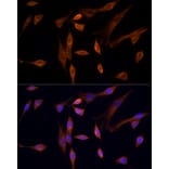 Immunofluorescence - Anti-MST3 Antibody (A13002) - Antibodies.com
