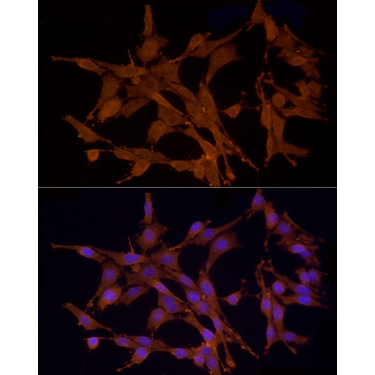 Immunofluorescence - Anti-MST3 Antibody (A13002) - Antibodies.com