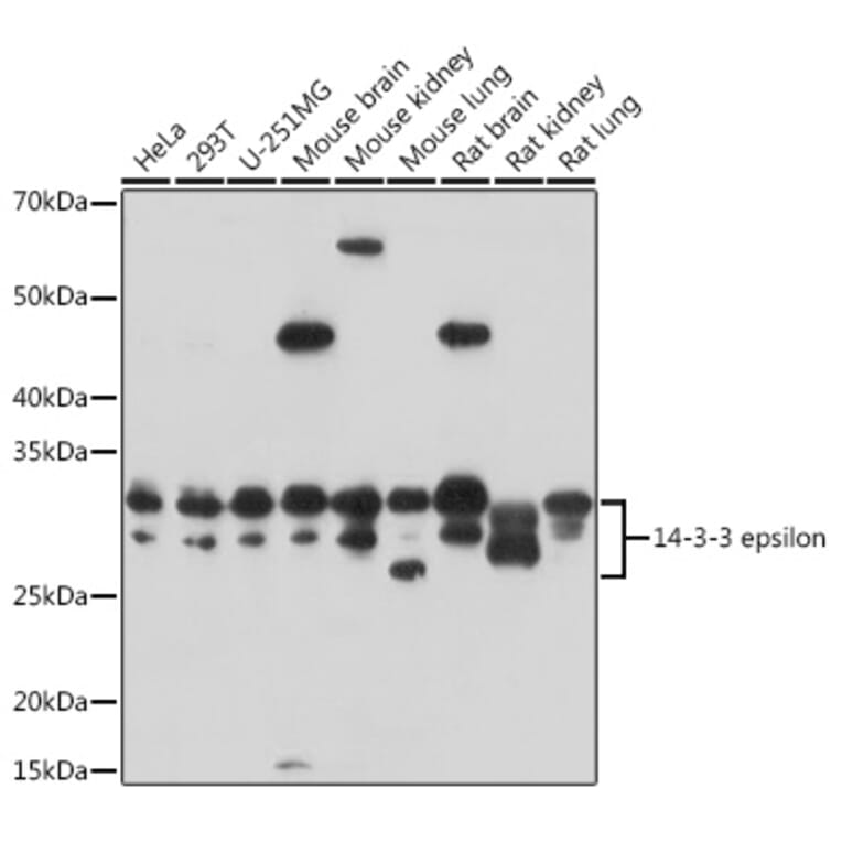 Western Blot - Anti-YWHAE Antibody (A13003) - Antibodies.com