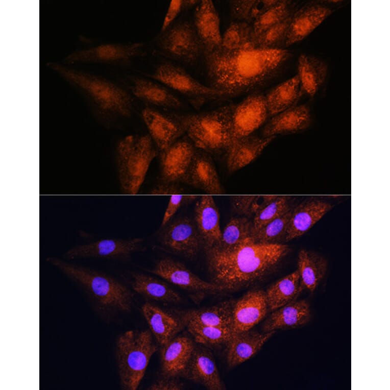 Immunofluorescence - Anti-YWHAE Antibody (A13003) - Antibodies.com