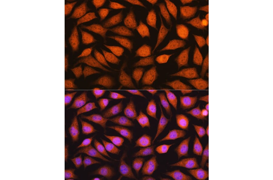 Immunofluorescence - Anti-YWHAE Antibody (A13003) - Antibodies.com