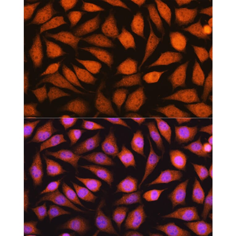 Immunofluorescence - Anti-YWHAE Antibody (A13003) - Antibodies.com