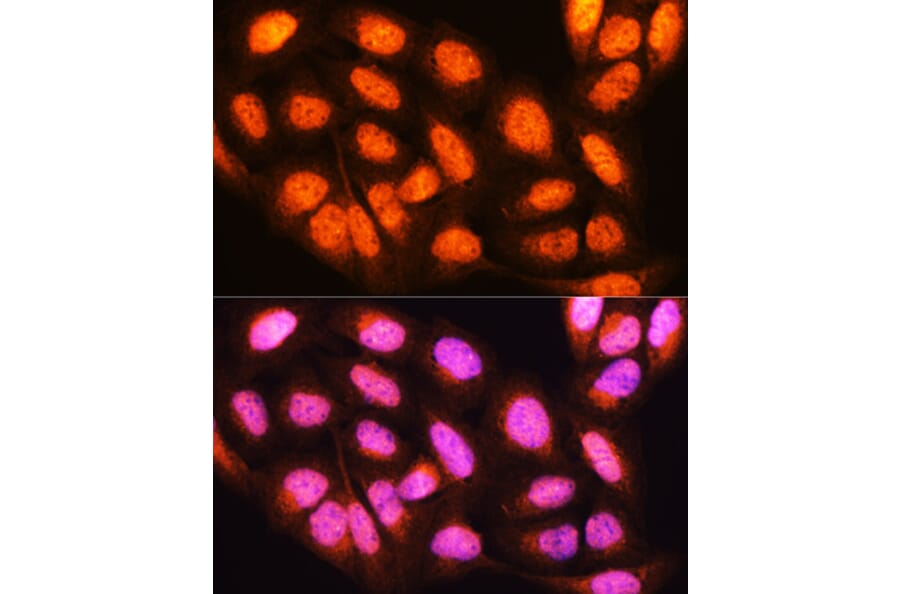 Immunofluorescence - Anti-YWHAE Antibody (A13003) - Antibodies.com