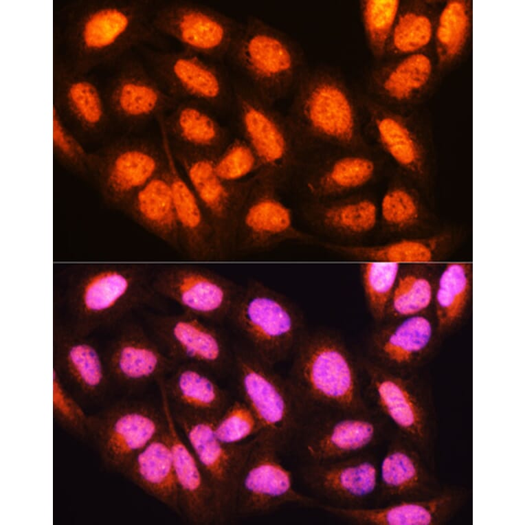 Immunofluorescence - Anti-YWHAE Antibody (A13003) - Antibodies.com