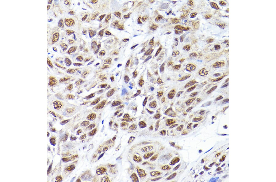 Immunohistochemistry - Anti-SEC14L2/TAP Antibody (A13004) - Antibodies.com