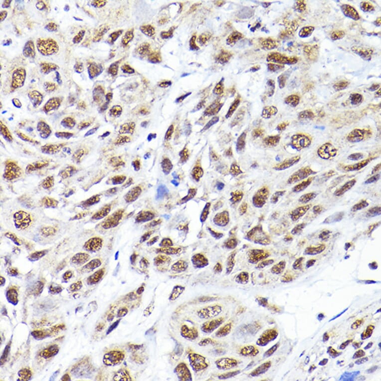 Immunohistochemistry - Anti-SEC14L2/TAP Antibody (A13004) - Antibodies.com