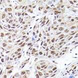 Immunohistochemistry - Anti-SEC14L2/TAP Antibody (A13004) - Antibodies.com