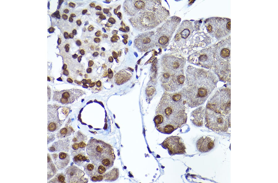 Immunohistochemistry - Anti-SEC14L2/TAP Antibody (A13004) - Antibodies.com