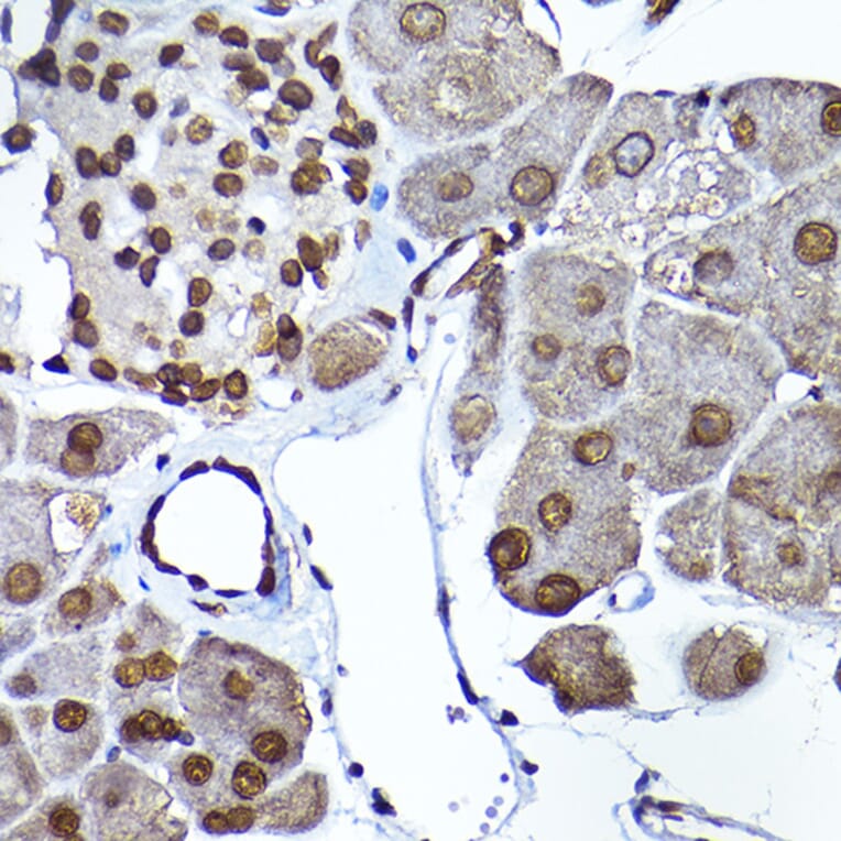 Immunohistochemistry - Anti-SEC14L2/TAP Antibody (A13004) - Antibodies.com