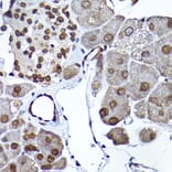 Immunohistochemistry - Anti-SEC14L2/TAP Antibody (A13004) - Antibodies.com