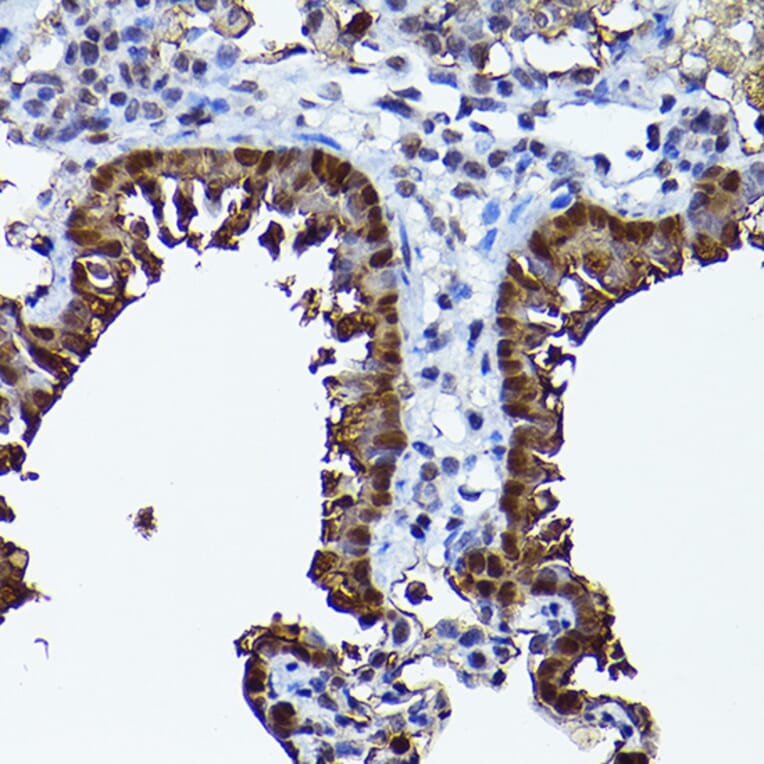 Immunohistochemistry - Anti-SEC14L2/TAP Antibody (A13004) - Antibodies.com