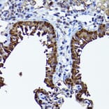 Immunohistochemistry - Anti-SEC14L2/TAP Antibody (A13004) - Antibodies.com