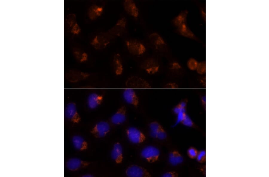 Immunofluorescence - Anti-SEC14L2/TAP Antibody (A13004) - Antibodies.com