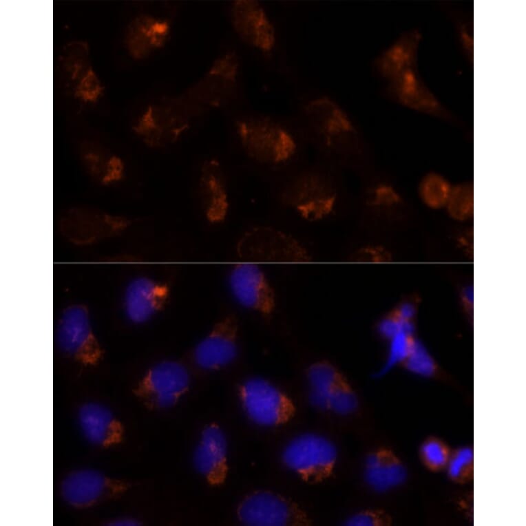 Immunofluorescence - Anti-SEC14L2/TAP Antibody (A13004) - Antibodies.com