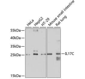 Western Blot - Anti-IL-17C Antibody (A13005) - Antibodies.com