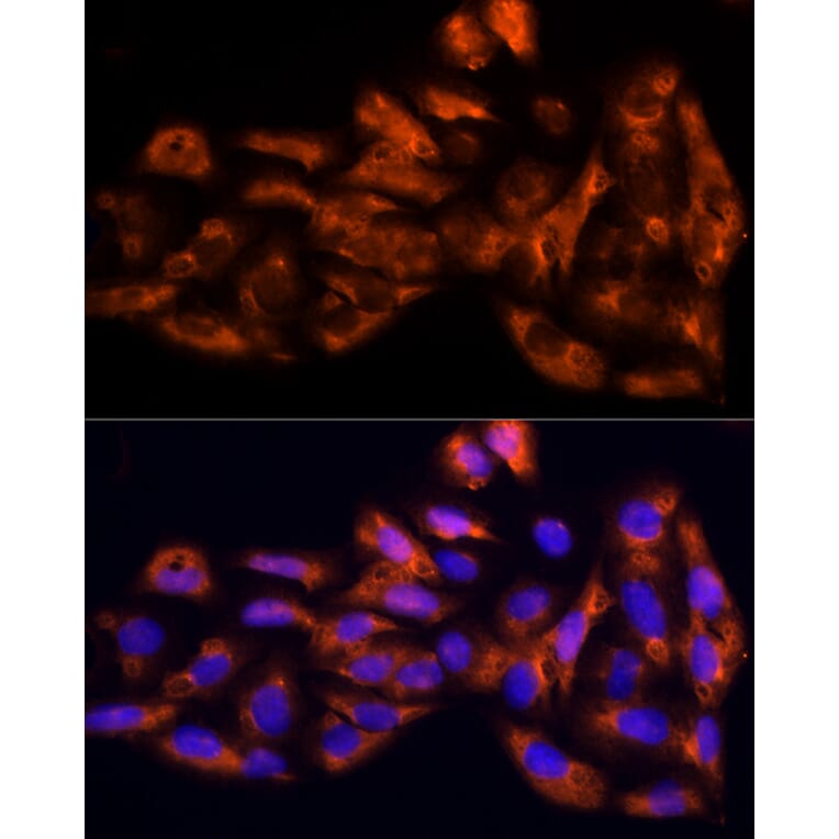 Immunofluorescence - Anti-IL-17C Antibody (A13005) - Antibodies.com