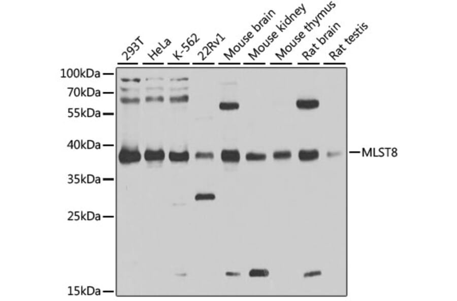 Western Blot - Anti-G protein beta subunit like/GBL Antibody (A13006) - Antibodies.com
