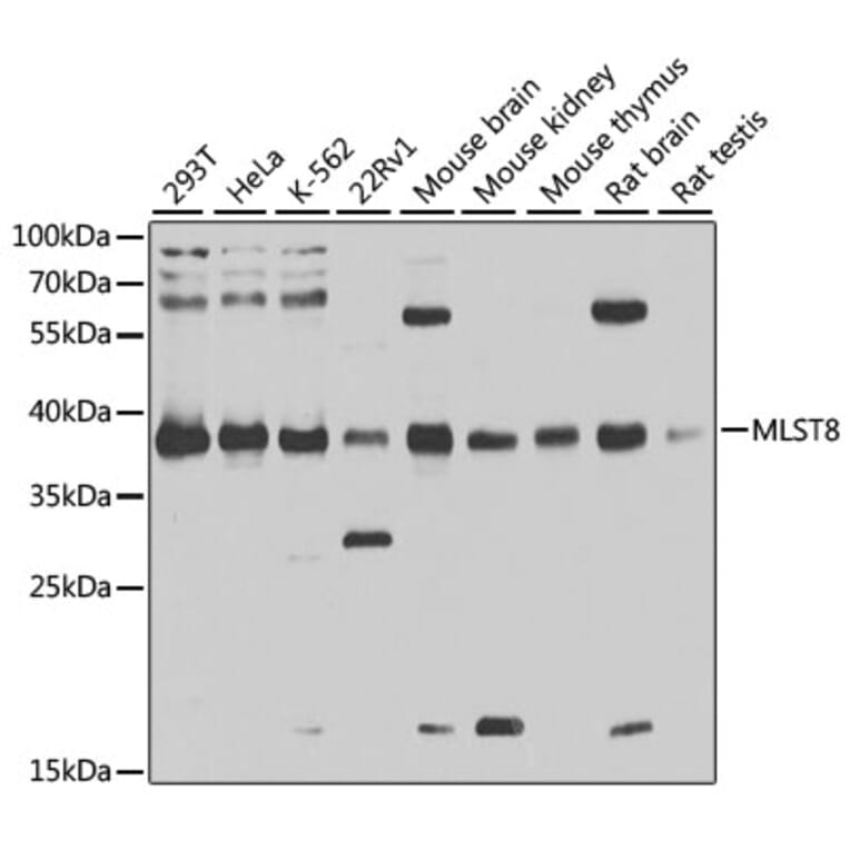 Western Blot - Anti-G protein beta subunit like/GBL Antibody (A13006) - Antibodies.com