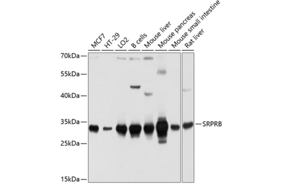 Western Blot - Anti-SRPRB Antibody (A13007) - Antibodies.com