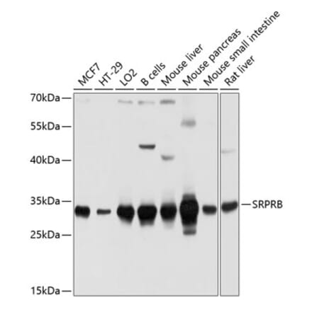 Western Blot - Anti-SRPRB Antibody (A13007) - Antibodies.com