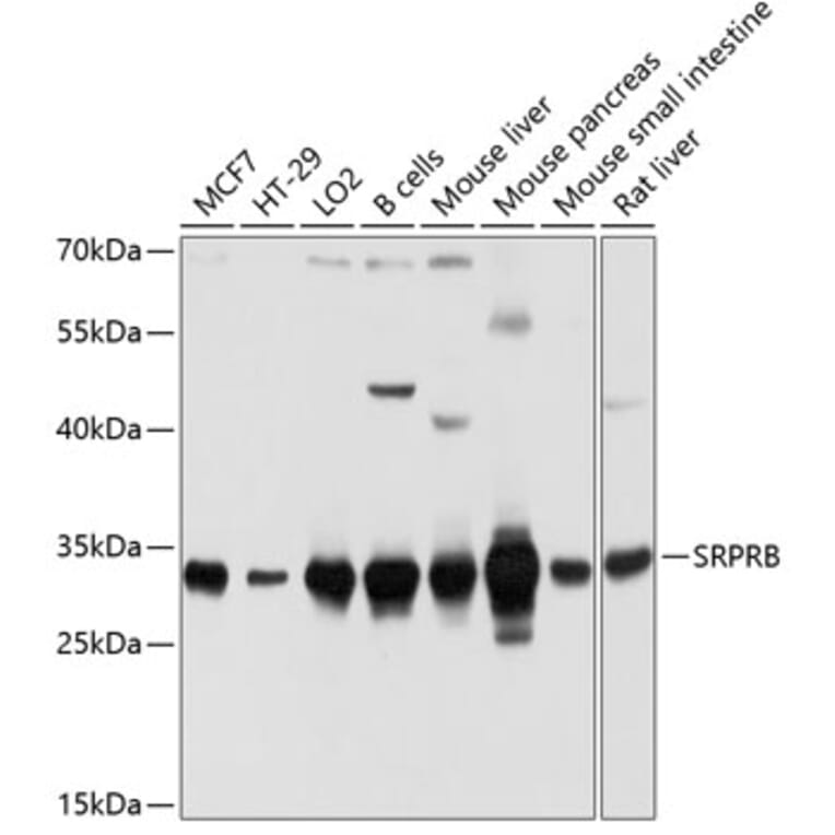 Western Blot - Anti-SRPRB Antibody (A13007) - Antibodies.com