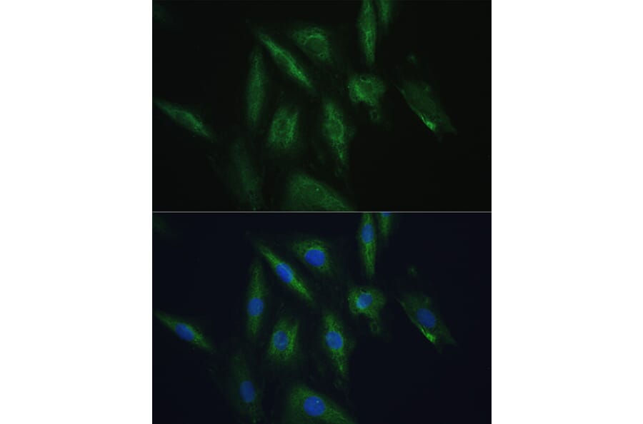 Immunofluorescence - Anti-SRPRB Antibody (A13007) - Antibodies.com
