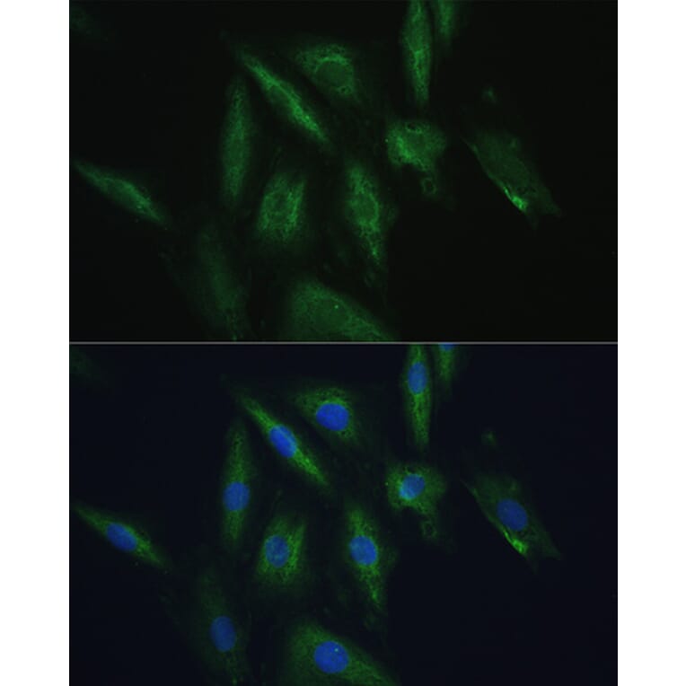 Immunofluorescence - Anti-SRPRB Antibody (A13007) - Antibodies.com