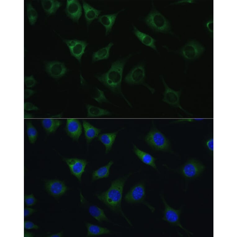 Immunofluorescence - Anti-SRPRB Antibody (A13007) - Antibodies.com