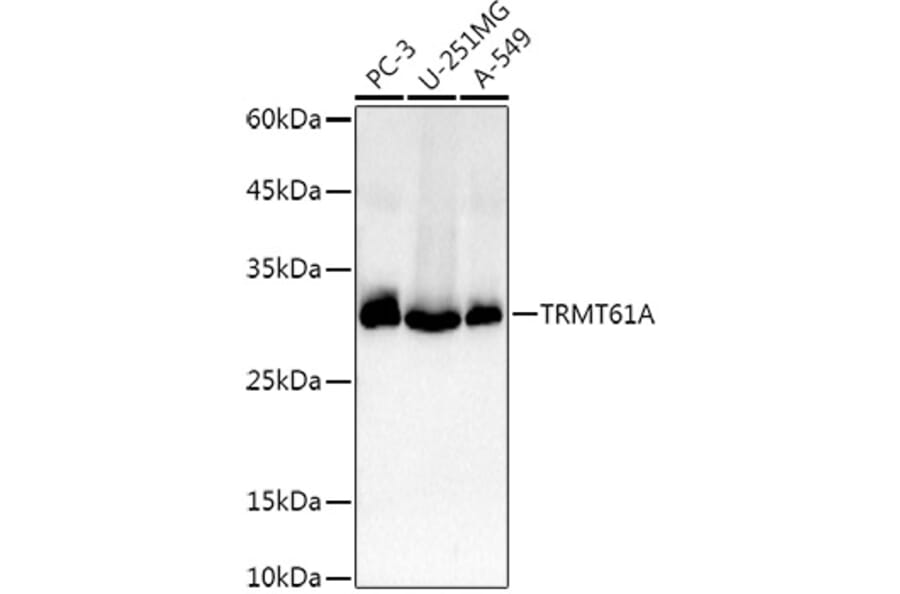 Western Blot - Anti-TRMT61A Antibody (A13009) - Antibodies.com