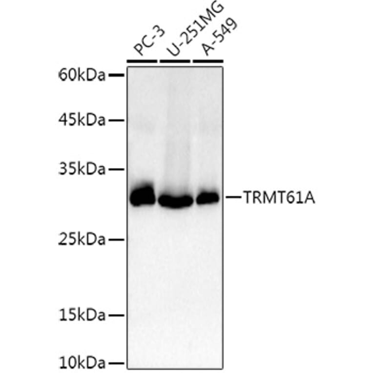 Western Blot - Anti-TRMT61A Antibody (A13009) - Antibodies.com