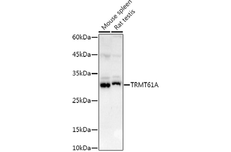 Western Blot - Anti-TRMT61A Antibody (A13009) - Antibodies.com
