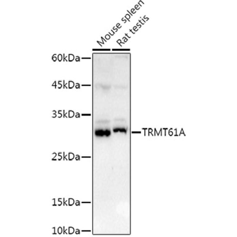 Western Blot - Anti-TRMT61A Antibody (A13009) - Antibodies.com