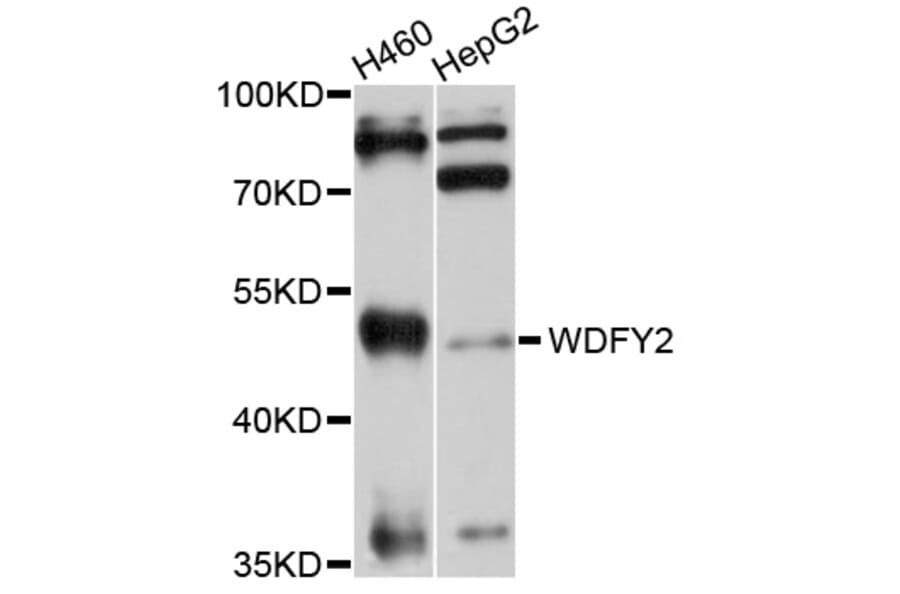 Western Blot - Anti-WDFY2 Antibody (A10598) - Antibodies.com
