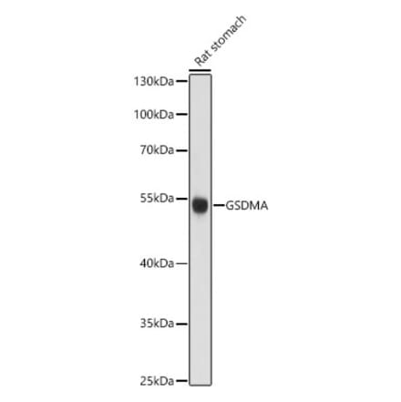 Western Blot - Anti-GSDMA Antibody (A13012) - Antibodies.com