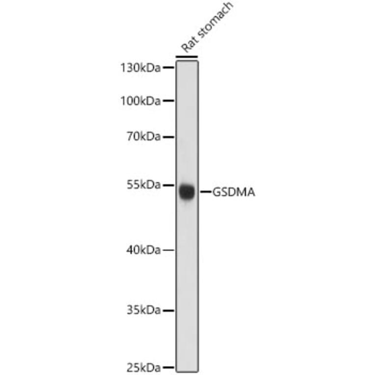Western Blot - Anti-GSDMA Antibody (A13012) - Antibodies.com