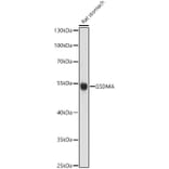 Western Blot - Anti-GSDMA Antibody (A13012) - Antibodies.com