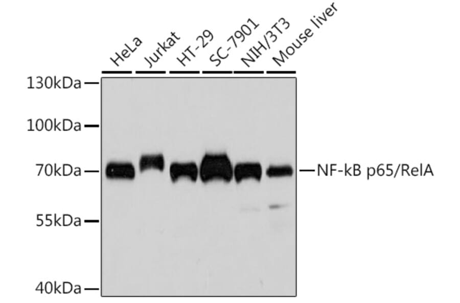 Western Blot - Anti-NF-kB p65 Antibody [AMC0486] (A13014) - Antibodies.com