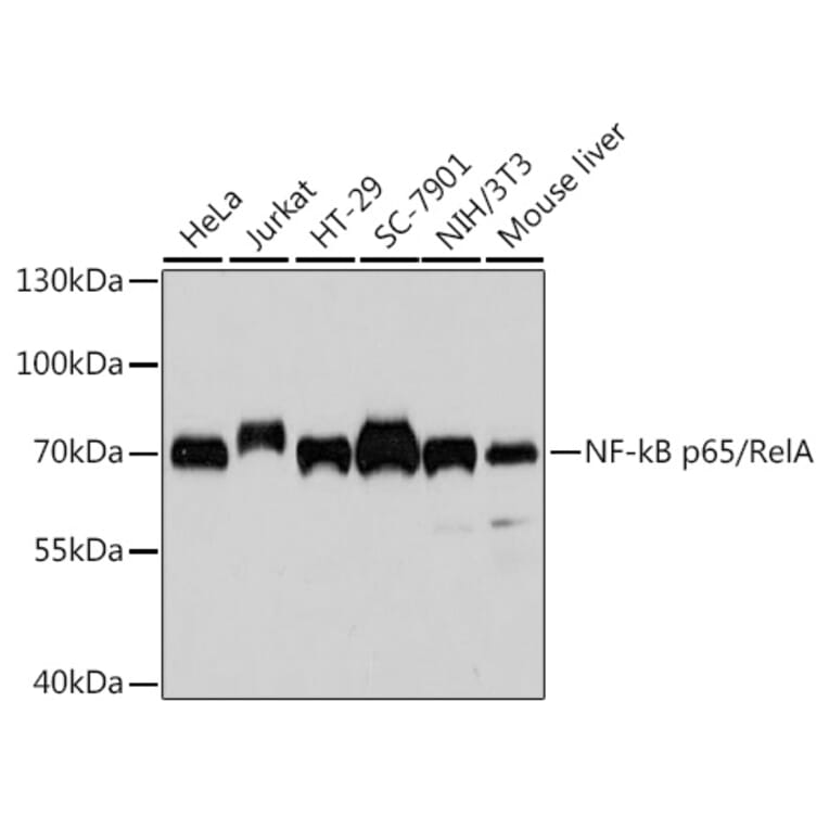 Western Blot - Anti-NF-kB p65 Antibody [AMC0486] (A13014) - Antibodies.com