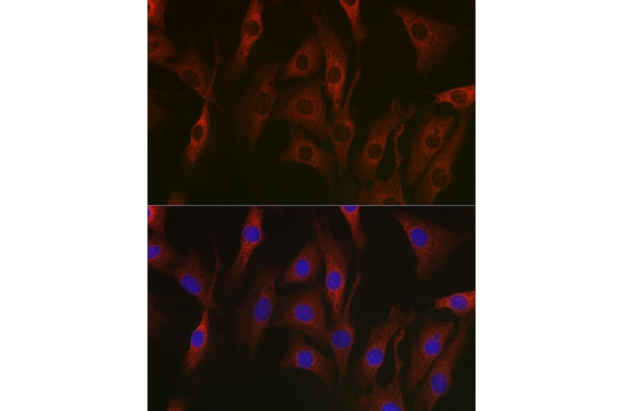 Immunofluorescence - Anti-NF-kB p65 Antibody [AMC0486] (A13014) - Antibodies.com